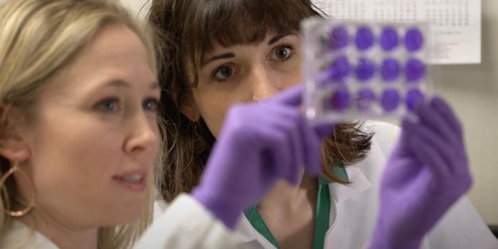 Zika Virus Found in Free Ranging Bats