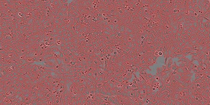 Targeting Aneuploidy in Cancer Cells