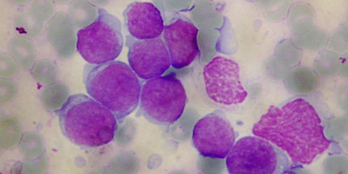 New T-Cell Leukemia Treatment Target Identified