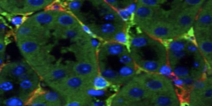 Progress in the Development of Gene Therapy for Diseased Kidneys