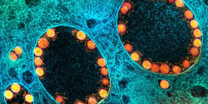 Over Half of Patients Infected in the Pandemic Experience 'Long COVID'