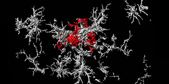 In a Twist, Researchers Suggest Some Alzheimer Plaques are Protective