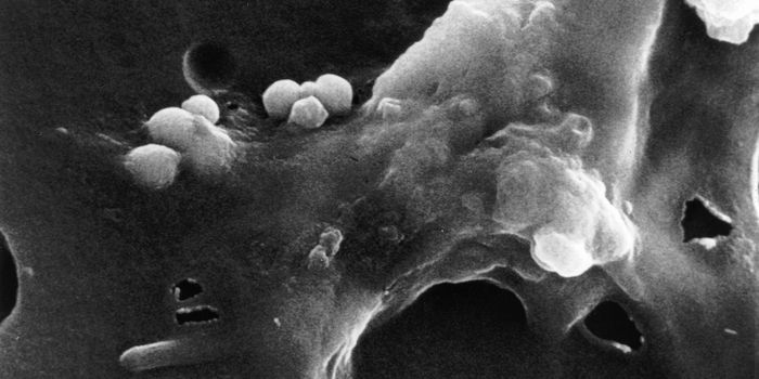 Study Uncovers a Distinct Strategy Immune Cells Use to "Eat" Cancer Cells