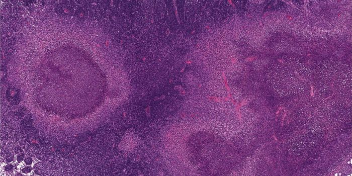 Cells Can Die When Infected so Others Can Live