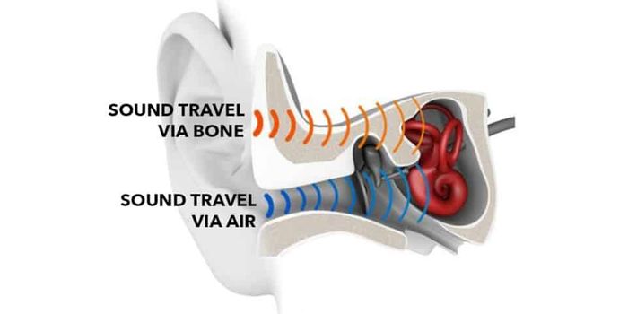Dental Implants Could Serve as Effective Hearing Aids