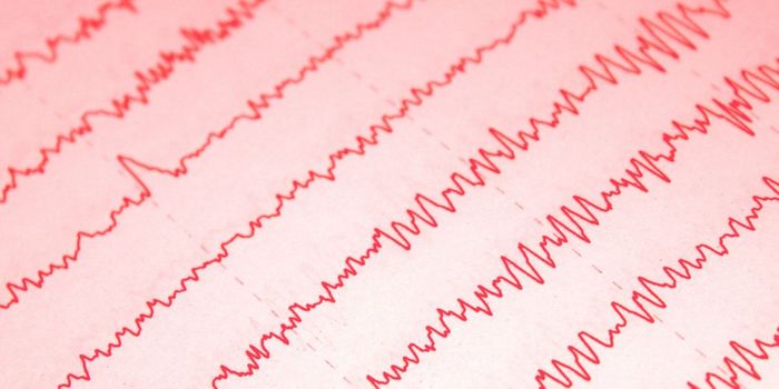 1-Minute At-Home EEG Test Could Diagnose Depression