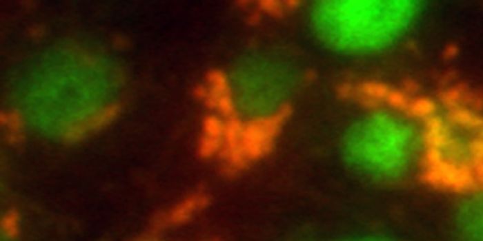 Stem Cells Lurking in Tumors Can Resist Treatment​​​​