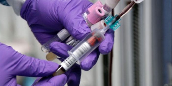 World's First Blood Test for Parkinson's Disease