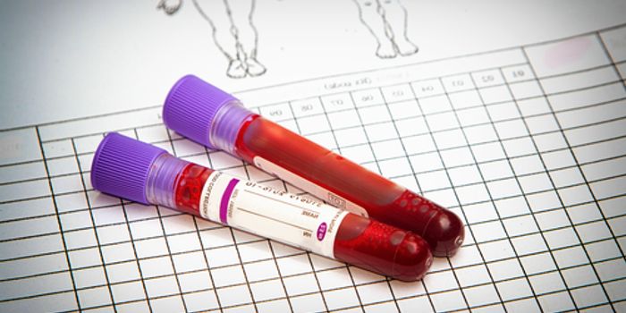 Researchers Test Blood-Based Biopsy for Finding Cancer