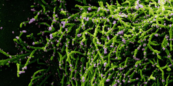 SARS-CoV-2 Infects Cells in the Brain & May Cause Structural Changes