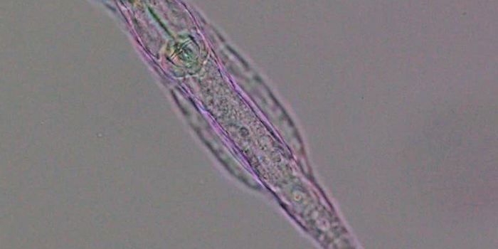 New Epigenetic Mark Discovered in Rotifers Originated in Bacteria