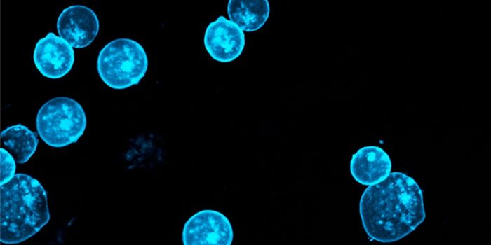 A new way to Alter Gene Expression may aid Leukemia Treatment