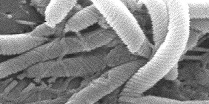 Researchers ID a Link Between a Bacterial Strain and Gastric Cancer