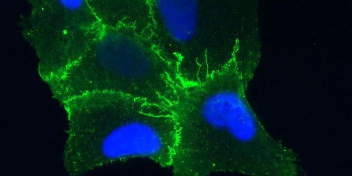 Researchers Learn How Hantavirus Infects Cells