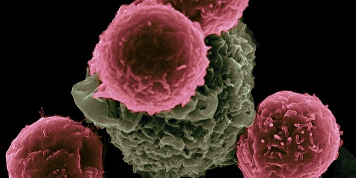 Attacking Cancer's Metabolism: A New Take on Fermented Wheat Germ Extract