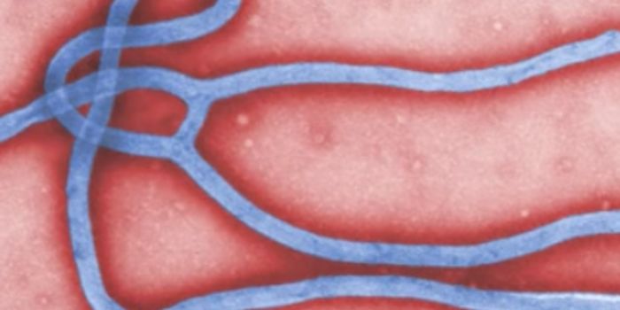 An Ebola Outbreak in the Democratic Republic of Congo