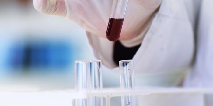 Engineered Immunotherapy Improves Brain Cancer Outcomes