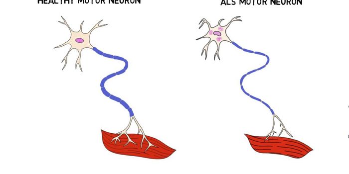 Possible Therapeutic Drugs for Inherited Form of ALS