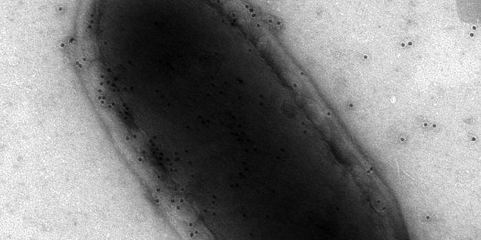 Computer Program Advances Food Safety Measures