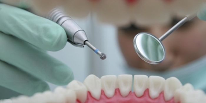 Study Finds "No-Drill" Dentistry Stops Tooth Decay
