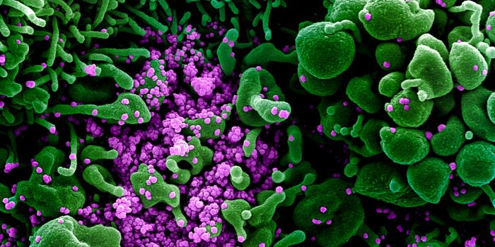 US Now Leads the World in Coronavirus Cases