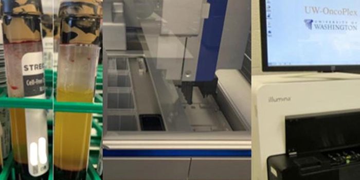 Potential Problems with Liquid Biopsies