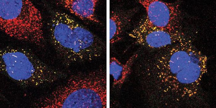 Cell Waste Disposal Pathway May Open New Treatment Options for Neurodegeneration