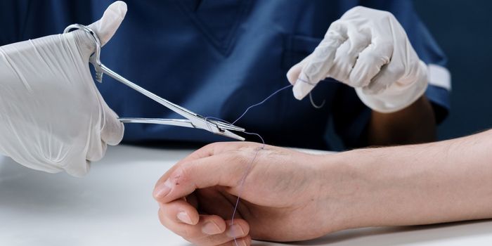 Antimicrobial suture reduces infection risk, simplifies post-operation monitoring