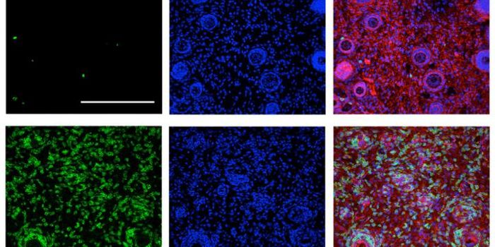 Uniting the Two Arms of the Immune System to Fight Cancer