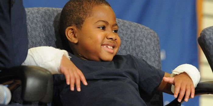First Pediatric Bilateral Hand Transplant a Success