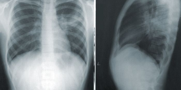Respiratory Hazards in The Cannabis Industry
