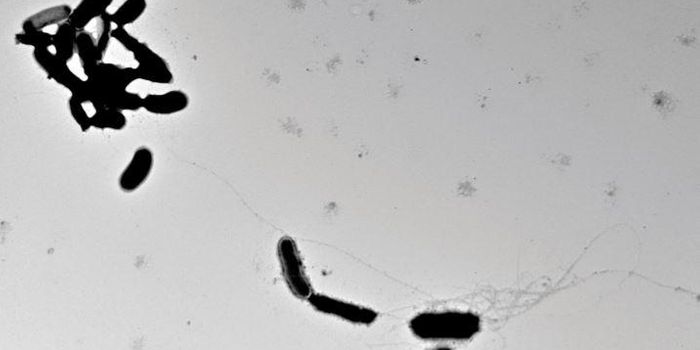 Might Alzheimer's Disease Stem From a Brain Infection?