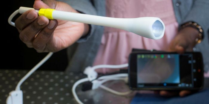 Finally, an Easier Way to Screen for Cervical Cancer