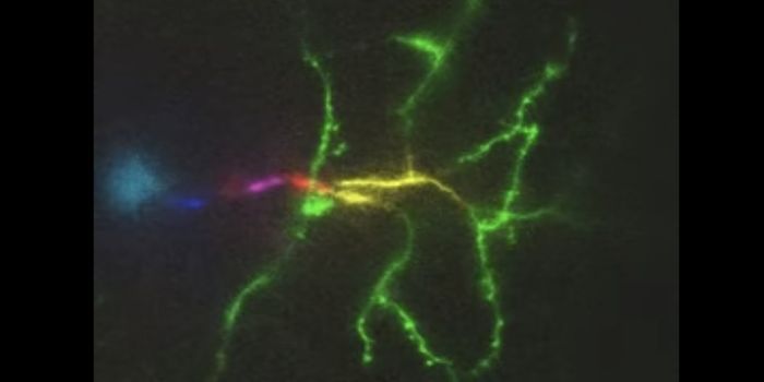 Capturing Images of Firing Neurons