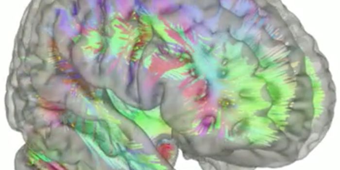 EEG Helps Determine the Right Depression Treatment