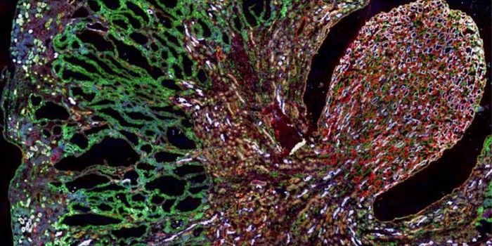 Relieving a Mechanism That Could Underlie as Many as 20 Rare Disorders