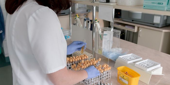 This model predicts those at high risk of pancreatic cancer