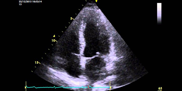 Tracing Cell Lineages Back to the Beginning of the Heart's Chambers