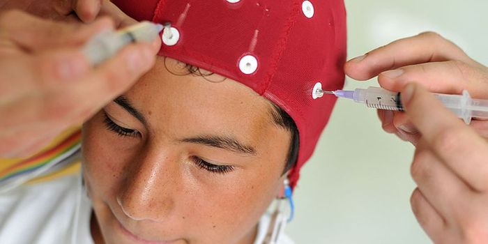 One Concussion Raises the Risk of Parkinson's Disease