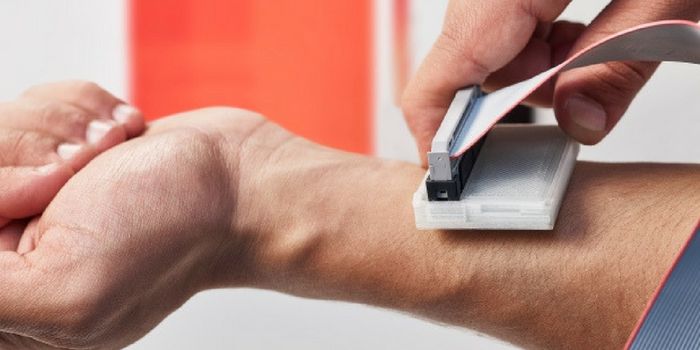 Skin Cancer Got sKanned