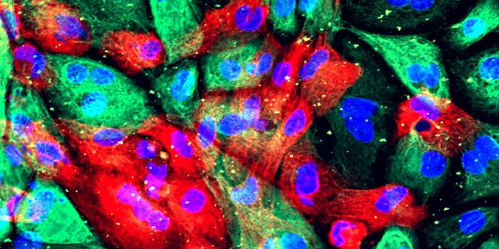 Breast Cancer Drug Increases Survival for Prostate Cancer Patients