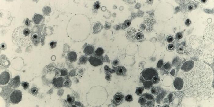 Studying the Genetic Impact of a Common Viral infection