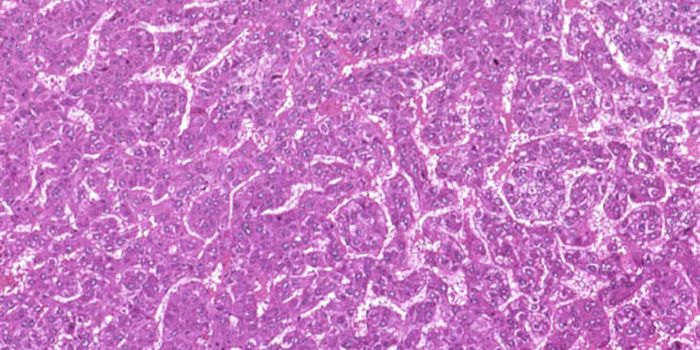 Improving Liver Cancer Therapy