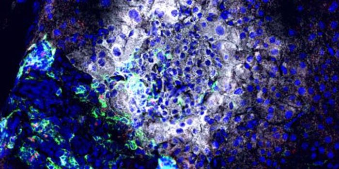 Mechanism Underlying Type I Diabetes Identified as Drug Target