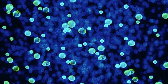 Exploring the Mystery of Archaea in the Vertebrate Gut