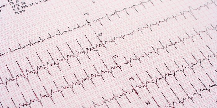 Top 5 Medical Tests to Predict Heart Disease