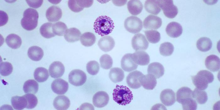 New Hope for An Effective Malaria Vaccine