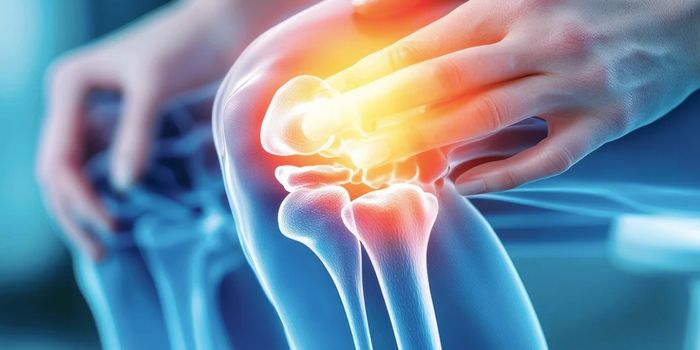 A Computational Tool That ID's Rheumatoid Arthritis Subtypes