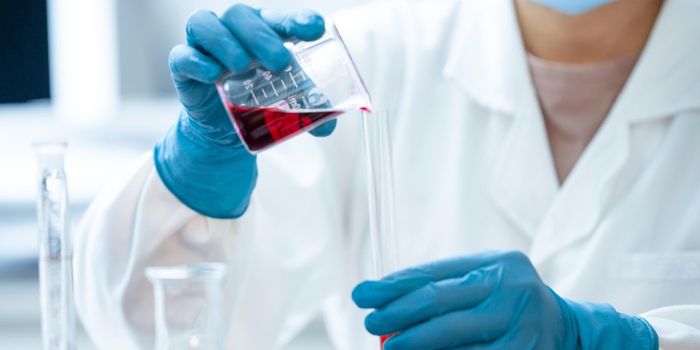 Scientists Find Bacteria in a Common Type of Kidney Stone