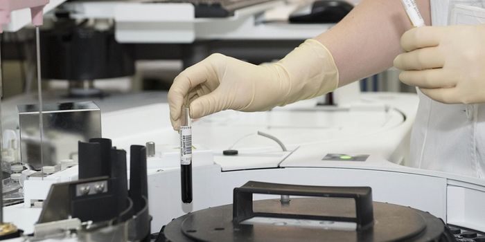 Genes Can Predict the Success of Some Weight Loss Drugs